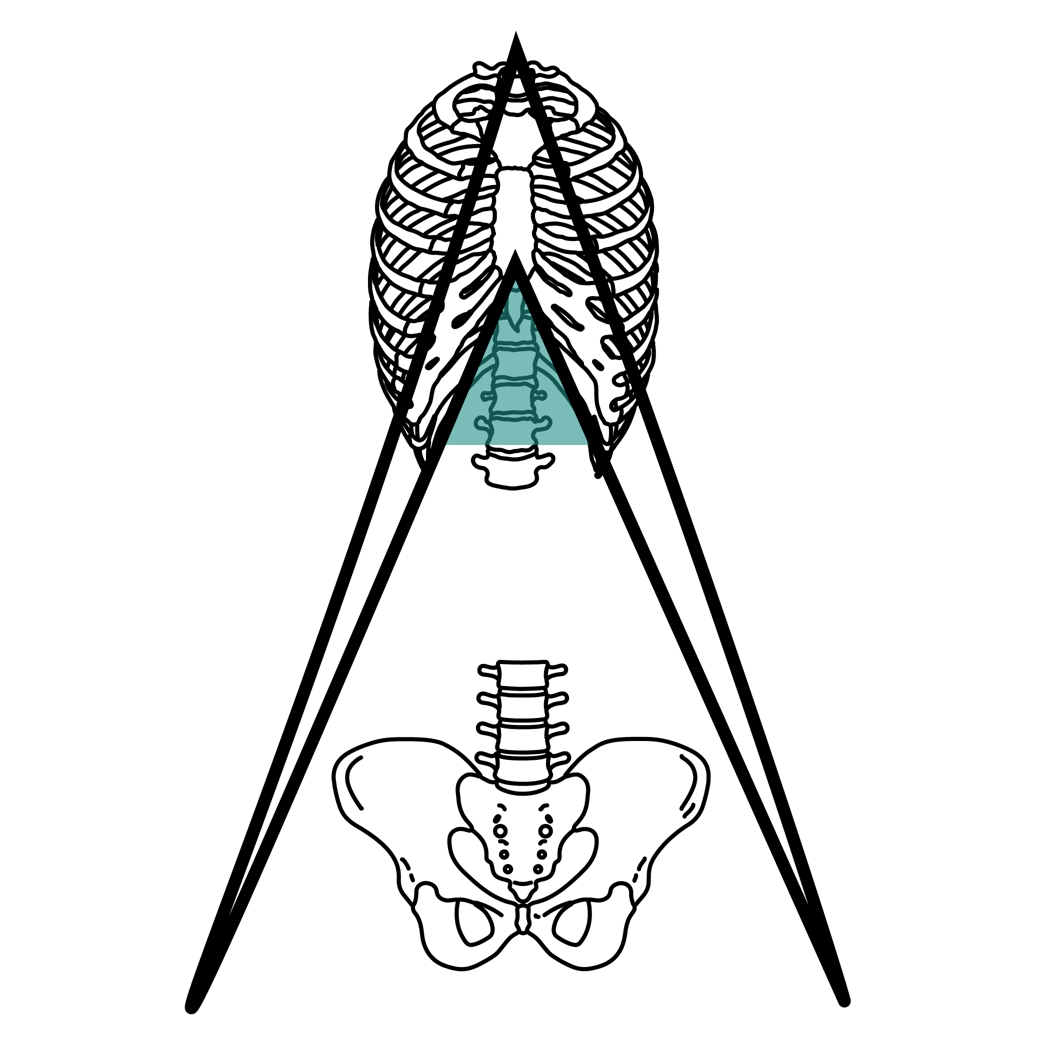 A-frame, closed rib angle